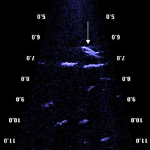 DIDSON imagery of a putative Atlantic Cod spawning event